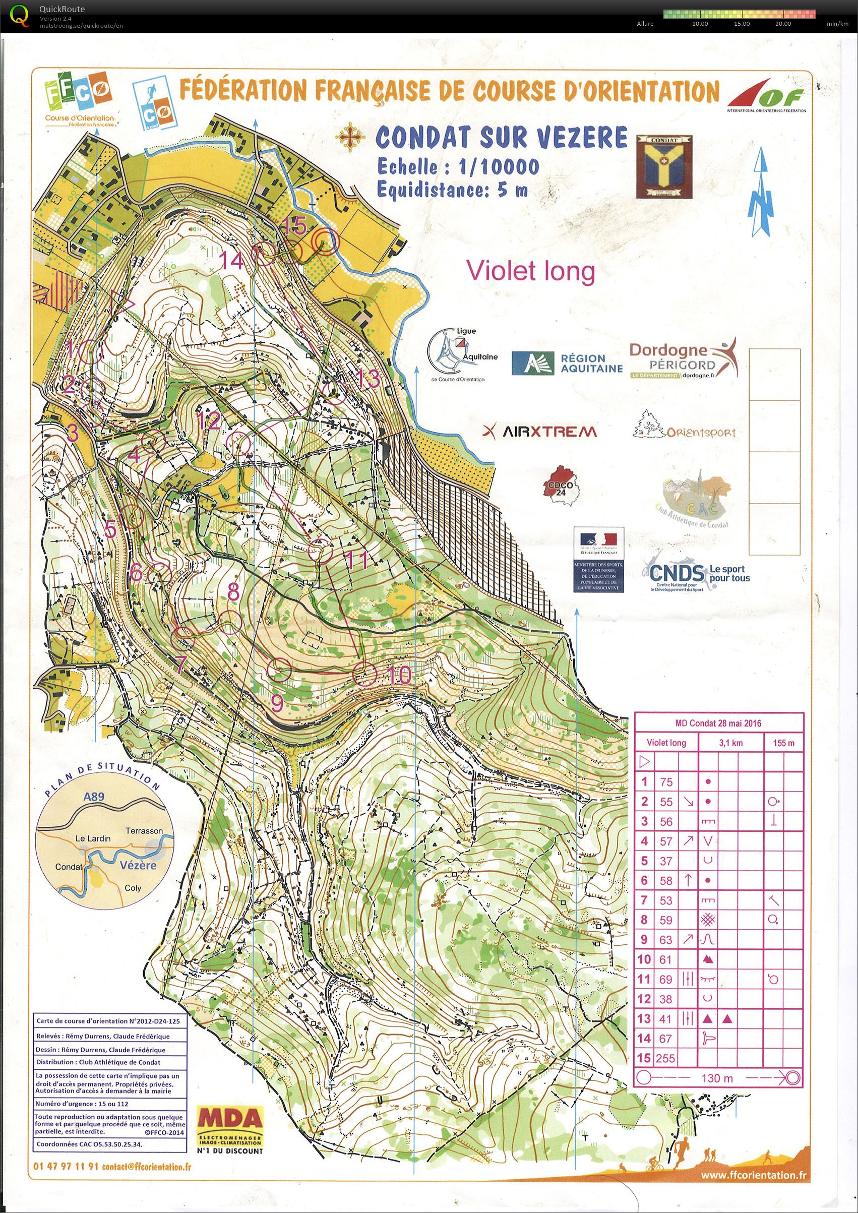 MD Condat NAT SO (28/05/2016)